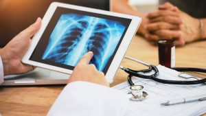 На пациентите се дава повече надежда, тъй като проучването открива най-доброто време за лечение на рак на белия дроб